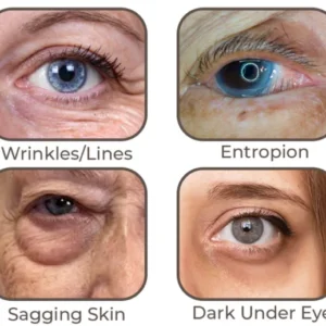 Electric Vibration Massage Eye Cream Tube - Image 5