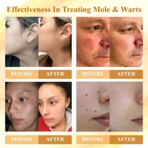 Condense Mellifera Venom Skin Repairing Cream - Image 5