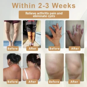 Turmeric Bone Sooth Gel - Image 2