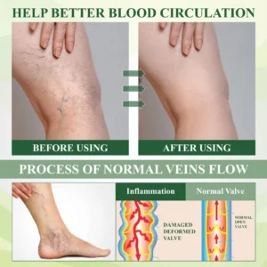 FluidEase Leg Therapy Edema Cream - Image 6