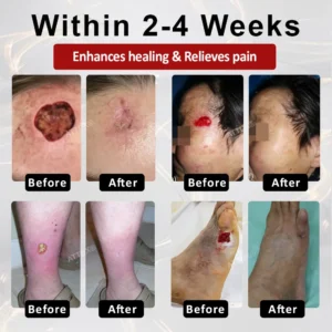 GlucoseGuard Skin Rescue Cream - Image 6