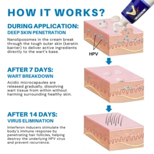 Warts Relief Cream - Image 5
