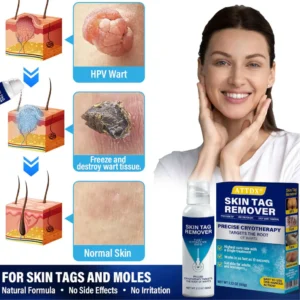 Treatment Spray - Image 2