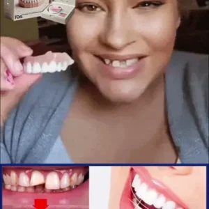 🦷Advanced Customized Full Denture Set🦷 - Image 6
