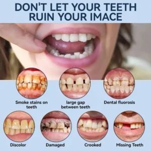 👧🏻🔆- 𝐏𝐫𝐞𝐦𝐢𝐮𝐦 𝐃𝐞𝐧𝐭𝐮𝐫𝐞- (✨Suitable for all mouth shapes, custom-made dentures for a perfect fit✨） - Image 9