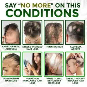 Herbal Infusion Hair Stimulation Set - Image 4