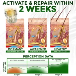Herbal Infusion Hair Stimulation Set - Image 7