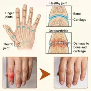 VenomEase Joint Cream - Image 9