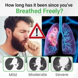 Lung health Detox Inhaler - Image 8