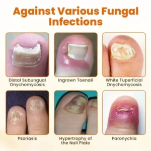 Bee Venom Nail Spray - Image 7