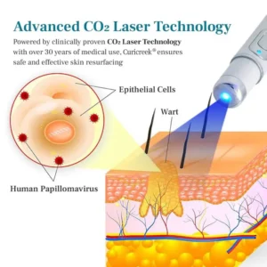 Mole and Wart Removal Laser Pen - Image 7