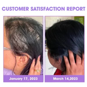 ✨👩‍🔬 Hair Root Repair Growth Drops - Image 4