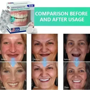 Full Denture with Strong Suction - Image 8