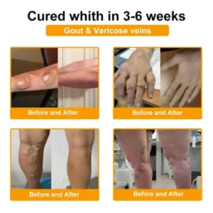 Pain-Relief Bone Healing Cream - Image 15