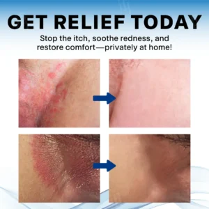 Scrotum Itchy Treatment Cream - Image 5