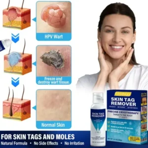 TagRecede Cryo Treatment Spray - Image 2