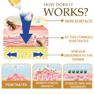 Bee Toxin Anti-Itch Cream - Image 5