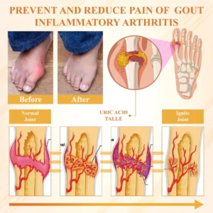 BeeEase MicroSting Joint Patches - Image 9