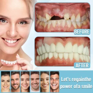 🦷Advanced Customized Full Denture Set🦷 -👨‍⚕️Mayo Clinic Certification🔥(Limited Time Discount Last 30 Minutes)🎁🎁 - Image 7