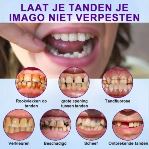 Geavanceerde op maat gemaakte volledige protheseset - Image 14