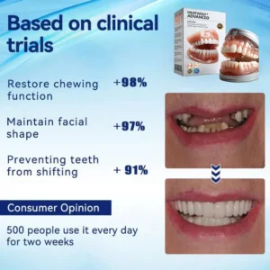 Premium Denture - Image 6