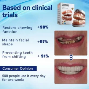 💝Premium Advanced Customized Full Denture Set 💝 (⏰Limited time discount last 30 minutes) - Image 6