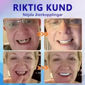 Alternative view of 🧡Premium Avancerat Anpassat Helprotes-set 🧡 (⏰Tidsbegränsad rabatt i 30 minuter)