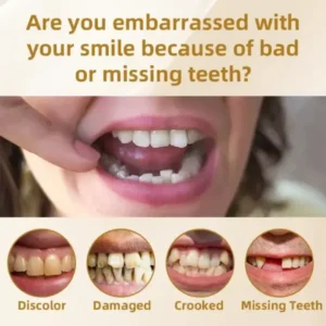 🦷Advanced Customized Full Denture Set🦷 (⏰Limited time discount last 30 minutes⏰)🚁🚁 - Image 8