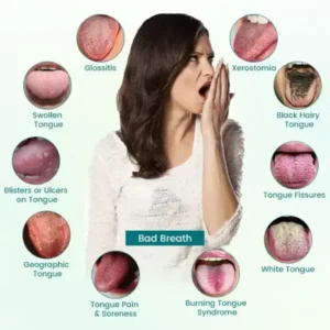GlosShield Tongue Repair Spray - Image 7