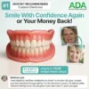 Custom-Fit Full Functional Dentures