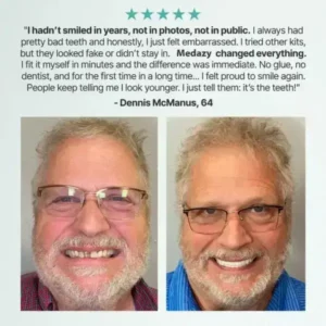 Custom-Fit Full Functional Dentures - Image 8