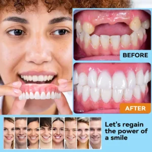 Silicone Reline Denture Set - Image 2