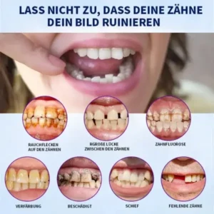 Fortgeschrittenes, maßgeschneidertes Vollprothesen-Set - Image 10