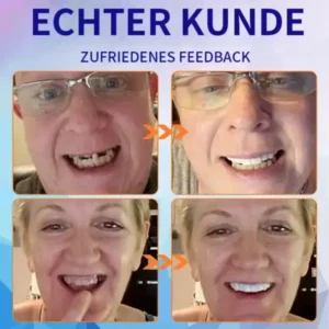 Fortgeschrittenes, maßgeschneidertes Vollprothesen-Set - Image 9
