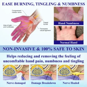 CoolEase Neuropathy Spray - Image 6