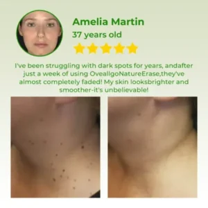Instant Mole & Spot Cream - Image 4