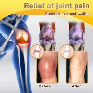 Bee Venom & Botulinum Toxin Joint Pain Relief & Repair Cream– Fast Relief & Joint Repair - Image 12