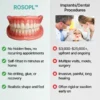 Custom-Fit Functional Dentures