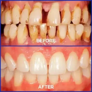 VioCore Bee Venom Dental Treatment Toothpaste - Image 7
