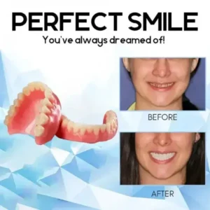 Premium Custom Silicone Denture Set - Image 10