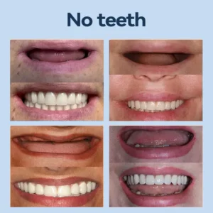 𝐀𝐝𝐚𝐩𝐭𝐢𝐯𝐞 𝐃𝐞𝐧𝐭𝐮𝐫𝐞𝐬 - Image 11