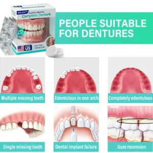 Suction-fit Complete Denture - Image 7