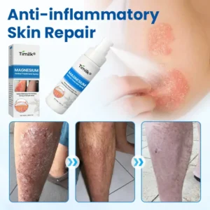 Magnesium Herbal Treatment Spray - Image 4