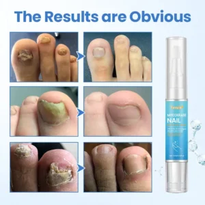 Nail Revive Pen - Image 5