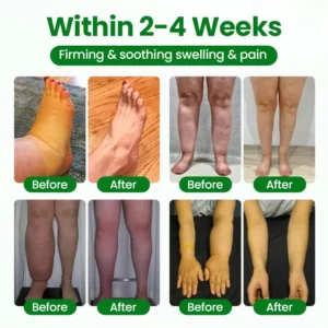 VenoLift Leg Relief Spray - Image 5