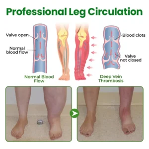 VenoLift Leg Relief Spray - Image 8