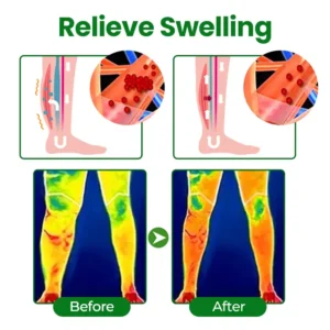 VenoLift Leg Relief Spray - Image 9