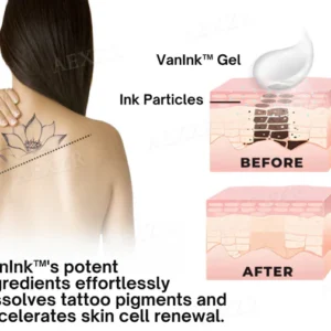 Tattoo Dissolving Gel - Image 10