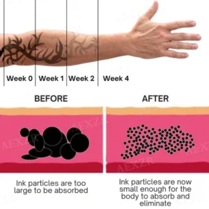 Tattoo Dissolving Gel - Image 9