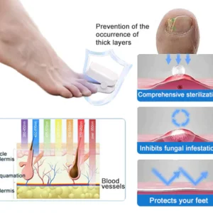 Powerful Light Therapy Device for Treating Nail Disorders - Image 8
